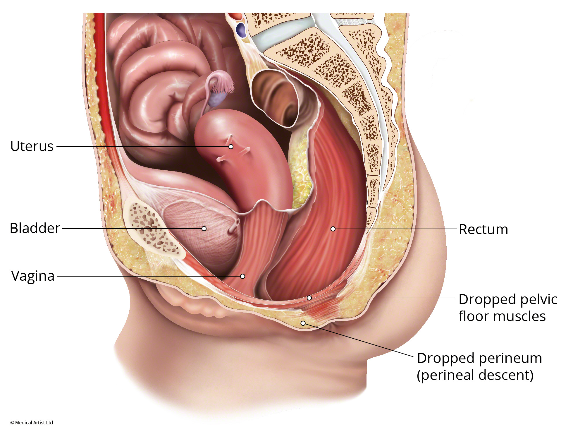 Pelvic And Perineal Surgeries